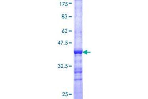 TUB Protein (AA 439-538) (GST tag)