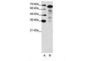 Image no. 2 for anti-MLX Interacting Protein-Like (MLXIPL) (N-Term) antibody (ABIN203213)