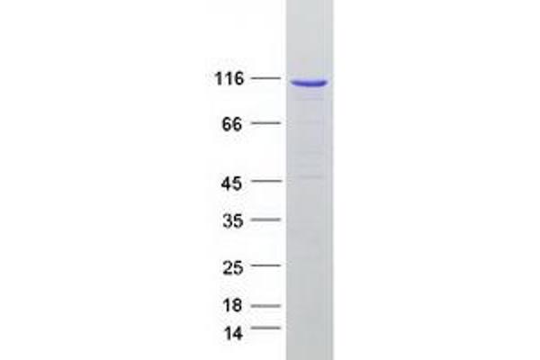 CCDC135 Protein (Myc-DYKDDDDK Tag)