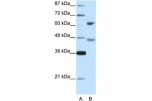 Image no. 1 for anti-Regulatory Factor X 4 (RFX4) (Middle Region) antibody (ABIN2777813)