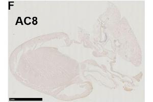 ADCY8 antibody  (AA 151-250)