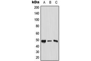 Image no. 2 for anti-Transcription Factor AP-2 gamma (Activating Enhancer Binding Protein 2 Gamma) (TFAP2C) (C-Term) antibody (ABIN2704482)