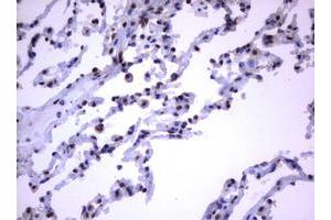 RASGRP3 anticorps  (AA 380-690)