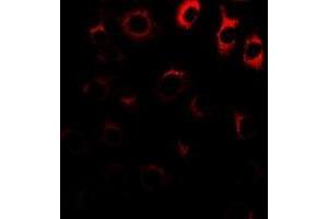 Image no. 3 for anti-Melanoma Antigen Family D, 1 (MAGED1) (full length) antibody (ABIN6043650)