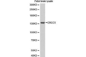 Western Blotting (WB) image for anti-DNA Repair Protein Complementing XP-G Cells (ERCC5) (AA 1-270) antibody (ABIN1512873)