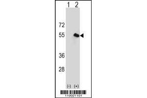 Western Blotting (WB) image for anti-Carboxypeptidase N Subunit 1 (CPN1) (Center) antibody (ABIN2160282)