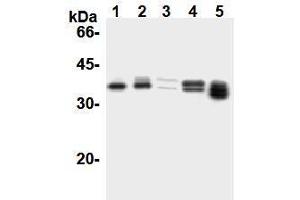 Image no. 3 for anti-Cyclin D1 (CCND1) antibody (ABIN1106871)