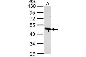 Image no. 3 for anti-Actin Related Protein 2/3 Complex, Subunit 1B, 41kDa (ARPC1B) (Center) antibody (ABIN2855610)