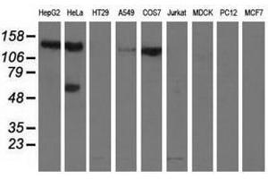 Image no. 2 for anti-L1 Cell Adhesion Molecule (L1CAM) antibody (ABIN1499090)