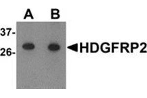 Image no. 1 for anti-Hepatoma-Derived Growth Factor-Related Protein 2 (HDGFRP2) (N-Term) antibody (ABIN783524)