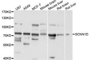 Image no. 1 for anti-Sodium Channel, Nonvoltage-Gated 1, delta (SCNN1D) antibody (ABIN4905100)