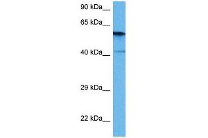 Image no. 4 for anti-Protein Phosphatase 3, Catalytic Subunit, alpha Isoform (PPP3CA) (Middle Region) antibody (ABIN2784524)
