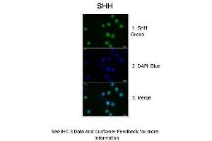 Image no. 6 for anti-Sonic Hedgehog (SHH) (N-Term) antibody (ABIN2781775)