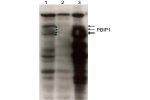 Image no. 1 for anti-MLF1 Interacting Protein (MLF1IP) (N-Term) antibody (ABIN401441)
