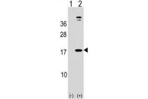 Western blot analysis of LEP antibody and 293 cell lysate (2 ug/lane) either nontransfected (Lane 1) or transiently transfected (2) with the human gene.