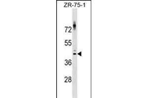 NKX2-1 Antibody (Center) (ABIN1538042 and ABIN2849358) western blot analysis in ZR-75-1 cell line lysates (35 μg/lane).