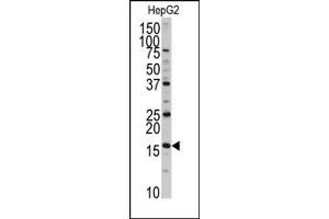 Image no. 1 for anti-DCTP Pyrophosphatase 1 (DCTPP1) (N-Term) antibody (ABIN357989)