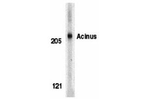 Image no. 1 for anti-Apoptotic Chromatin Condensation Inducer 1 (ACIN1) (Middle Region) antibody (ABIN1030843)