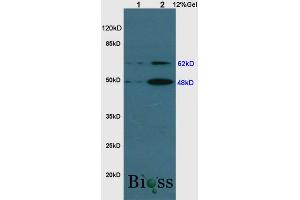 Image no. 3 for anti-Sequestosome 1 (SQSTM1) (AA 51-150) antibody (ABIN682153)