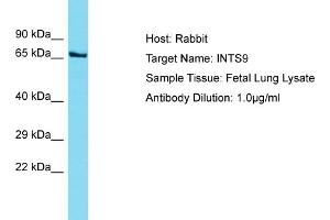 Image no. 1 for anti-Integrator Complex Subunit 9 (INTS9) (C-Term) antibody (ABIN2791591)