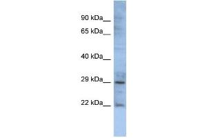Image no. 3 for anti-Gap Junction Protein, beta 1, 32kDa (GJB1) (Middle Region) antibody (ABIN2774854)