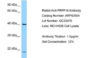 Image no. 1 for anti-PRP18 Pre-mRNA Processing Factor 18 (PRPF18) (N-Term) antibody (ABIN2789288)