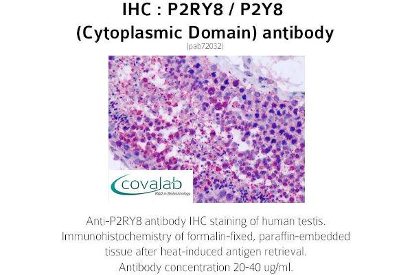 anti-Purinergic Receptor P2Y, G-Protein Coupled, 8 (P2RY8) (3rd Cytoplasmic Domain) antibody