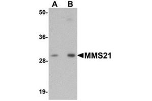 Image no. 1 for anti-E3 SUMO-Protein Ligase NSE2 (NSMCE2) (C-Term) antibody (ABIN783606)