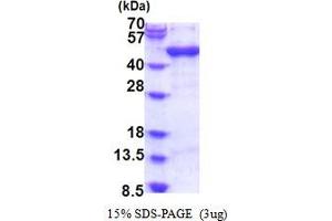Image no. 1 for ADP-Ribosylation Factor Interacting Protein 1 (ARFIP1) (AA 1-373) protein (His tag) (ABIN6387486)