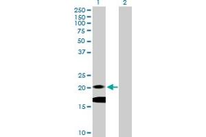 Image no. 1 for anti-Interleukin 7 (IL7) (AA 1-177) antibody (ABIN517059)