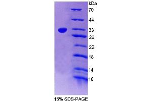 Image no. 1 for Protein tyrosine Phosphatase, Non-Receptor Type 2 (PTPN2) (AA 1-237) protein (His tag) (ABIN6239491)