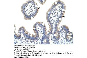 Image no. 1 for anti-NF-kappa-B inhibitor beta (NFKBIB) (C-Term) antibody (ABIN2775837)