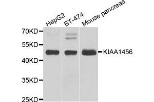 Image no. 1 for anti-KIAA1456 (KIAA1456) antibody (ABIN2563549)