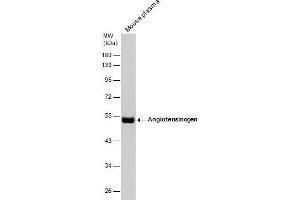 anti-Angiotensinogen (serpin Peptidase Inhibitor, Clade A, Member 8) (AGT) (Center) antibody