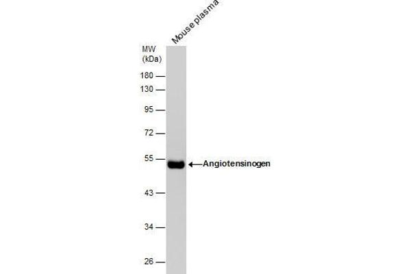 anti-Angiotensinogen (serpin Peptidase Inhibitor, Clade A, Member 8) (AGT) (Center) antibody