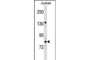 UHRF2 Antibody (Center) (ABIN1538450 and ABIN2850120) western blot analysis in Jurkat cell line lysates (35 μg/lane).