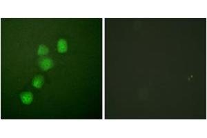 Image no. 1 for anti-Cyclin E1 (CCNE1) (AA 361-410) antibody (ABIN1532243)