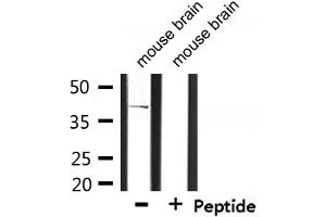 Image no. 2 for anti-CD2 (Cytoplasmic Tail) Binding Protein 2 (CD2BP2) antibody (ABIN6260588)