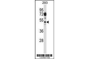 Image no. 1 for anti-FLT3-Interacting Zinc Finger 1 (FIZ1) (AA 376-405), (C-Term) antibody (ABIN657429)