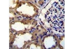 PDGFC antibody immunohistochemistry analysis in formalin fixed and paraffin embedded human kidney tissue.