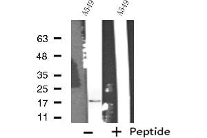 Image no. 1 for anti-Cytochrome C Oxidase Subunit Va (COX5A) antibody (ABIN6258416)