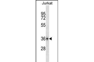 ZN Antibody (Center) (ABIN1537998 and ABIN2849075) western blot analysis in Jurkat cell line lysates (35 μg/lane).