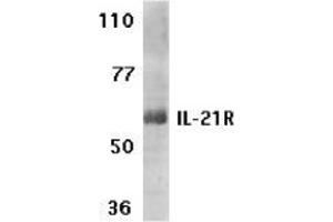 Image no. 1 for anti-Interleukin 21 Receptor (IL21R) (N-Term) antibody (ABIN499990)