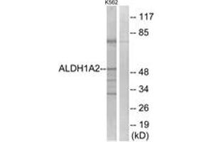 Image no. 1 for anti-Aldehyde Dehydrogenase 1 Family, Member A2 (ALDH1A2) (AA 412-461) antibody (ABIN1535291)