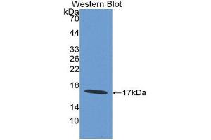 Image no. 1 for anti-WAP Four-Disulfide Core Domain 5 (WFDC5) (AA 1-123) antibody (ABIN1980544)