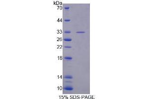 Image no. 1 for Exportin 4 (XPO4) protein (ABIN6119565)