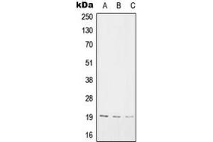 Image no. 1 for anti-Sorting Nexin 3 (SNX3) (Center) antibody (ABIN2707082)