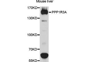 Western blot analysis of extracts of mouse liver cells, using PPP1R3A antibody.