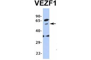 Image no. 5 for anti-Vascular Endothelial Zinc Finger 1 (VEZF1) (Middle Region) antibody (ABIN2776482)