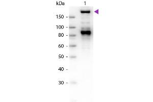 Image no. 3 for anti-alpha-2-Macroglobulin (A2M) antibody (ABIN103762)